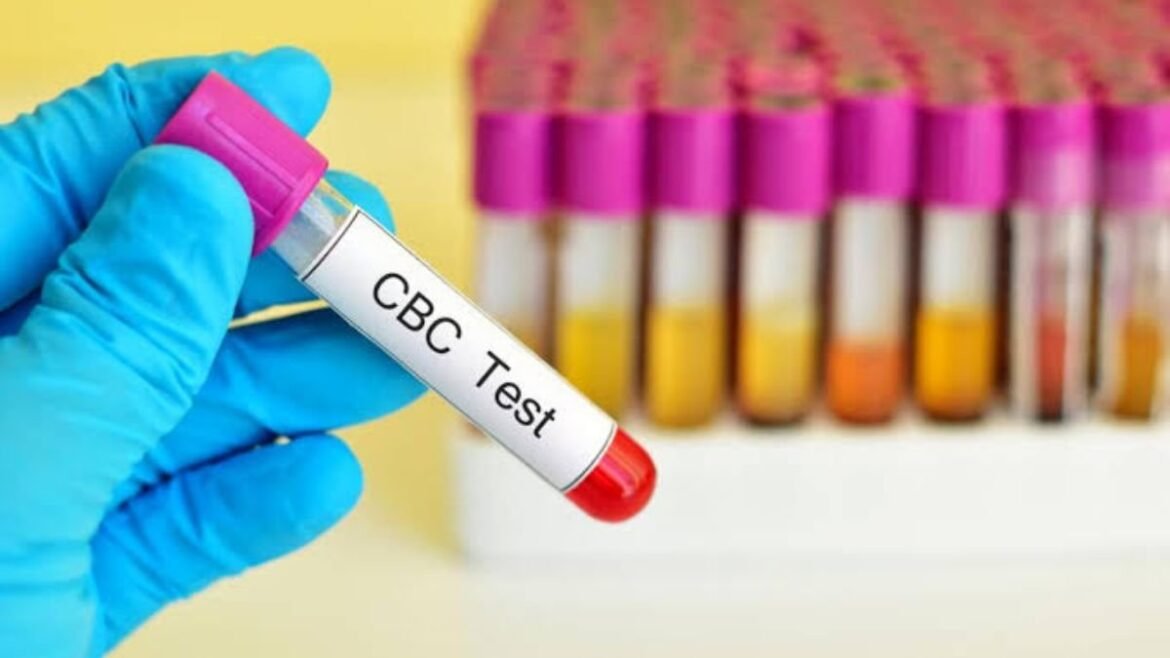 Reasons You Were Prescribed CBC Test